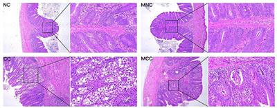 Exploration of the Mechanism of the Control of Coccidiosis in Chickens Based on Network Pharmacology and Molecular Docking With the Addition of Modified Gegen Qinlian Decoction